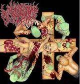 Curettage Embryological Negligent